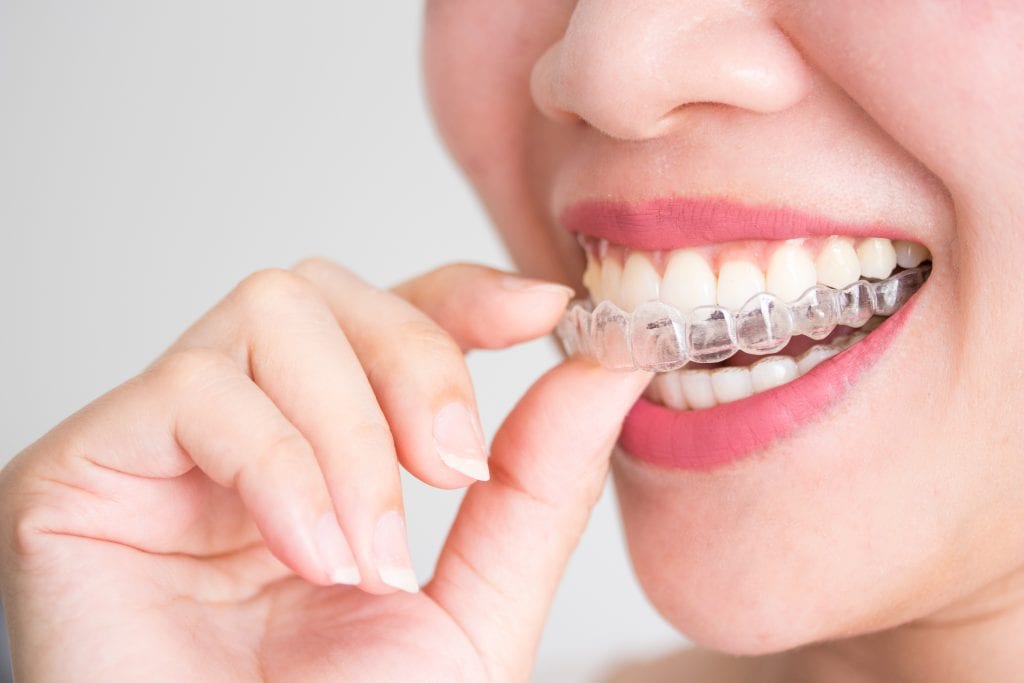 invisalign danbury ct