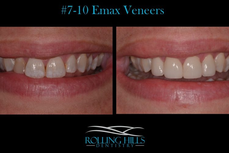 danbury cosmetic dentistry