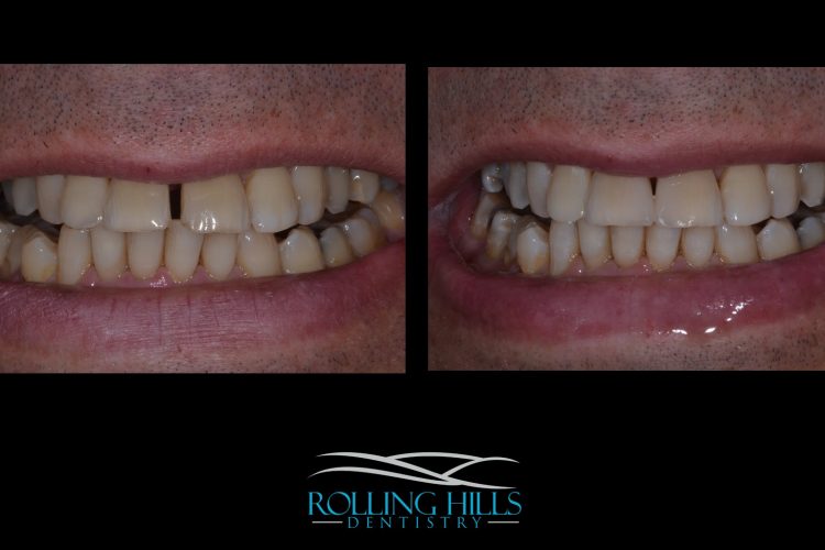 dental composite danbury ct