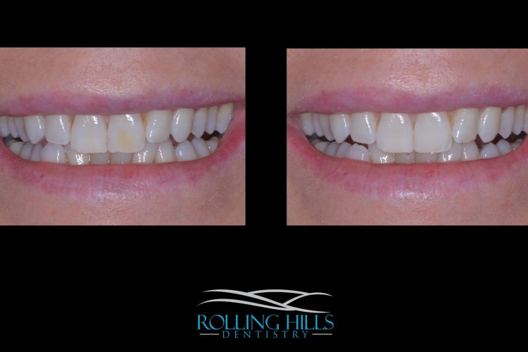 danbury cosmetic dentist