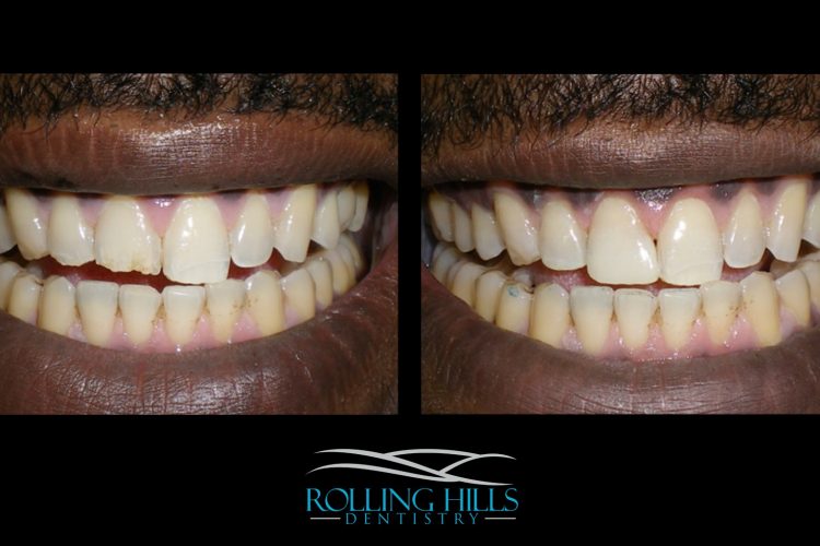 danbury cosmetic dentist ct