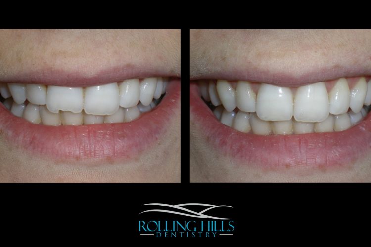 danbury ct cosmetic dentist